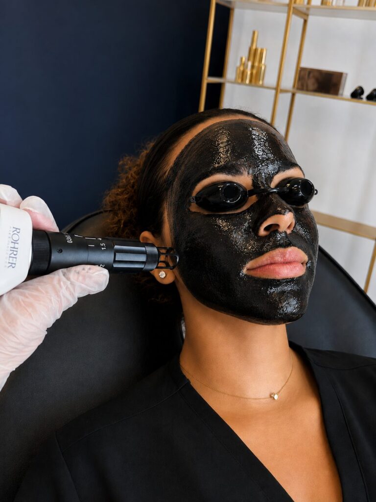 Carbon laser facial at Laser Loft