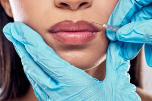 A dermal filler treatment in a clinic