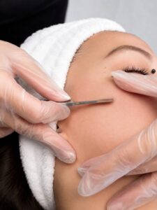 Dermaplaning at Laser Loft