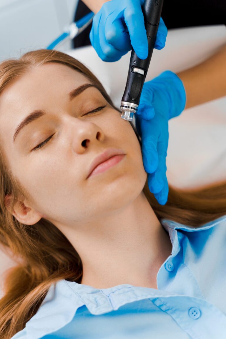 HydraFacial handpiece on a cheek