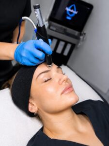 HydraFacial at Laser Loft