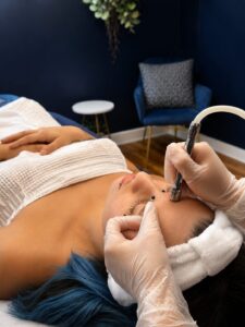 Microdermabrasion at Laser Loft