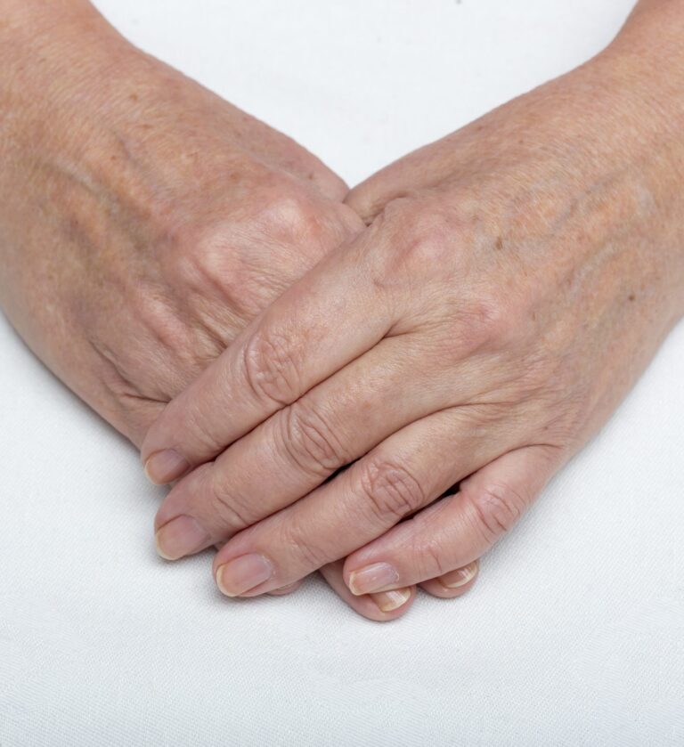 Back of the hands with visible veins