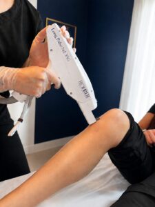 Vein and pigmentation treatment at Laser Loft